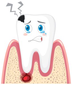 sac dentar